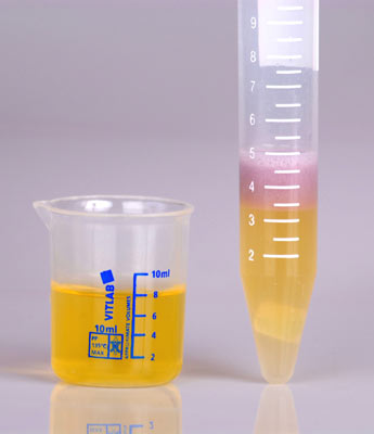 Heavy Metals Test - The World's home method of screening heavy metals